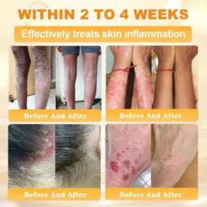 Cheemex® Bee Venom Skin Restoration Cream image Cheemex® Bee Venom Skin Restoration Cream