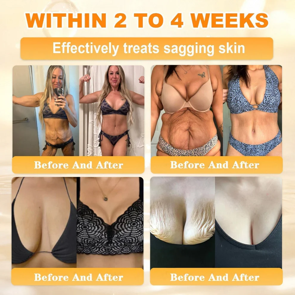 Cheemex® Bee Venom Skin Restoration Cream image Cheemex® Bee Venom Skin Restoration Cream