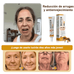 𝐅𝐮𝐫𝐳𝐞𝐫𝐨™ Botox Anti-Wrinkle Cream with Bee Venom image 𝐅𝐮𝐫𝐳𝐞𝐫𝐨™ Botox Anti-Wrinkle Cream with Bee Venom