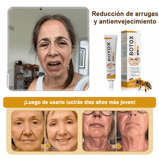𝐅𝐮𝐫𝐳𝐞𝐫𝐨™ Botox Anti-Wrinkle Cream with Bee Venom image 𝐅𝐮𝐫𝐳𝐞𝐫𝐨™ Botox Anti-Wrinkle Cream with Bee Venom
