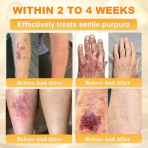 Cheemex® Bee Venom Skin Restoration Cream image Cheemex® Bee Venom Skin Restoration Cream