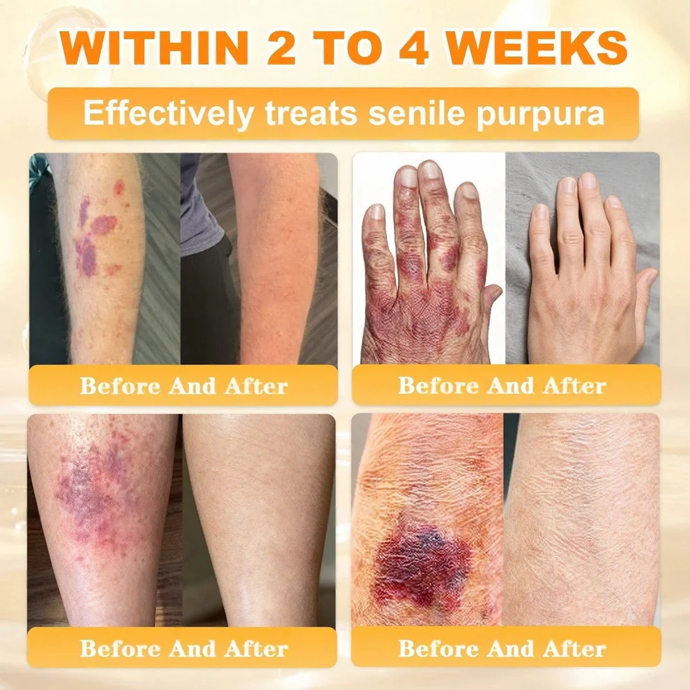 Cheemex® Bee Venom Skin Restoration Cream image Cheemex® Bee Venom Skin Restoration Cream