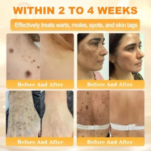 Cheemex® Bee Venom Skin Restoration Cream image Cheemex® Bee Venom Skin Restoration Cream