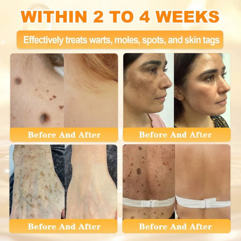 Cheemex® Bee Venom Skin Restoration Cream image Cheemex® Bee Venom Skin Restoration Cream