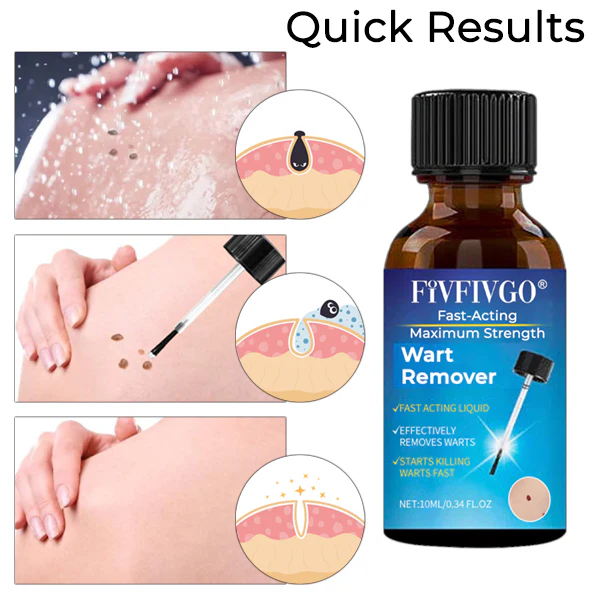 Fivfivgo® Fast-Acting Maximum Strength Wart Remover image Fivfivgo® Fast-Acting Maximum Strength Wart Remover