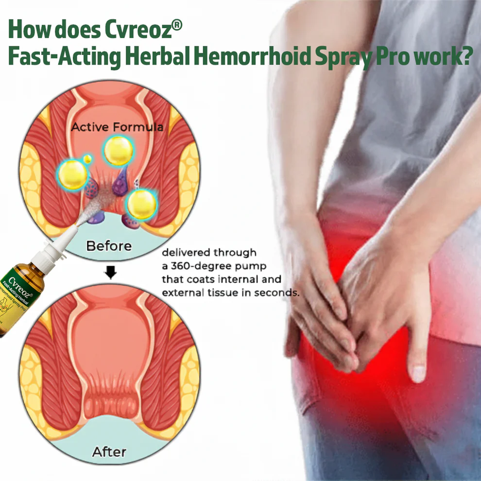 Cvreoz® Fast-Acting Herbal Hemorrhoid Spray Pro image Cvreoz® Fast-Acting Herbal Hemorrhoid Spray Pro