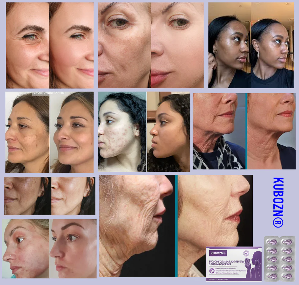 KUBOZN® Exosome Cellular Age-Reverse & Firming Capsules image KUBOZN® Exosome Cellular Age-Reverse & Firming Capsules