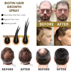 VitaGrow™ Biotin Hair Growth Spray