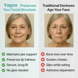 Yagoo™ Medical Full Denture